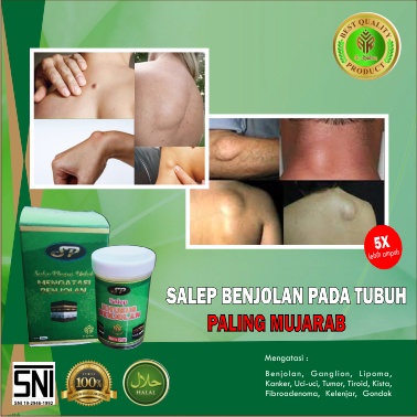 SALEP AR-RAIHAN - TERAMPUH ATASI BENJOLAN - SALEP BENJOLAN - KISTA - SALEP GONDOK - TUMOR - UCI UCI benjolan . kelenjar getah bening. keloid - tiroid - obat kista - obat  - obat benjolan paling ampuh - obat kista -  - minya