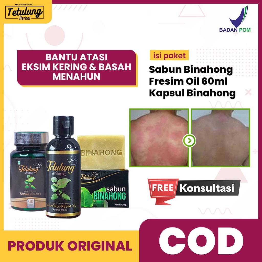 Paket Obat Eksim Kering &amp; Basah Ampuh Seluruh Badan - Kapsul Binahong + Obat Eksim Fresim Oil 60ml + Sabun Mandi Gatal Binahong