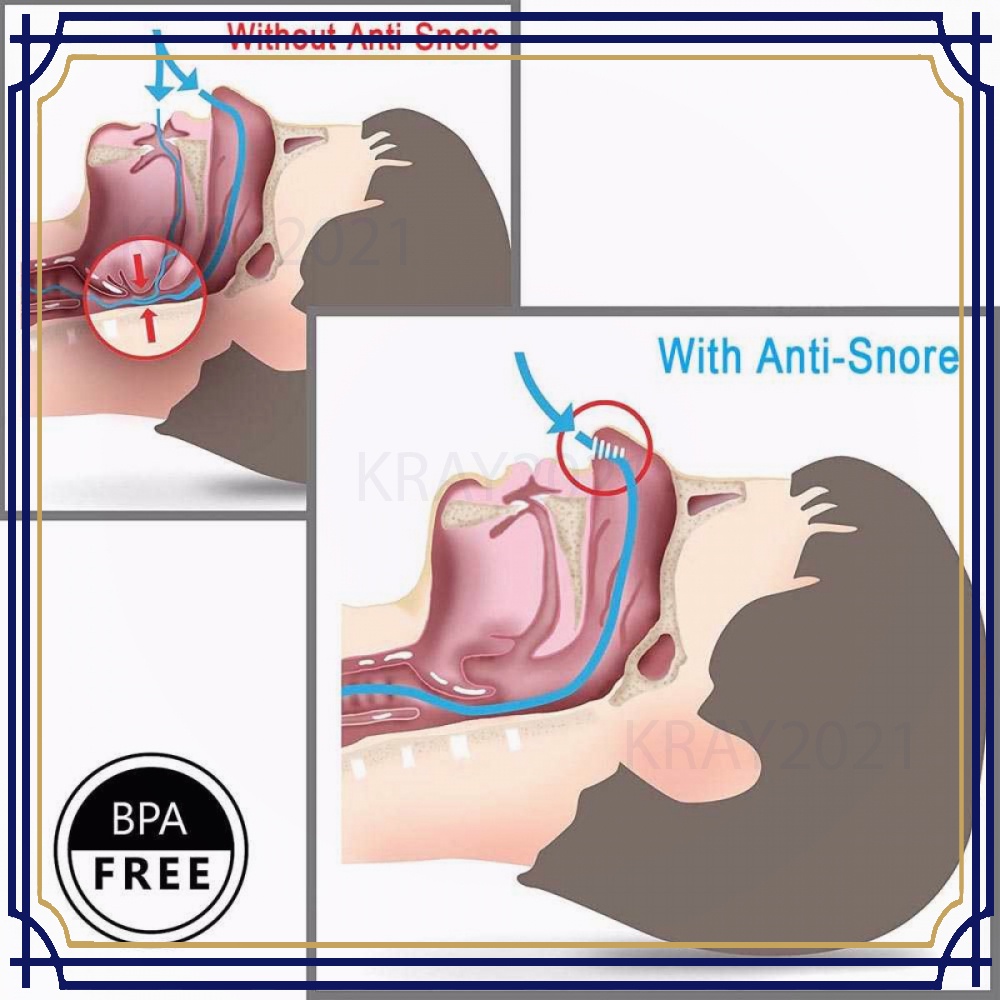 Anti Ngorok Pernafasan Hidung Stop Snoring Solution - HL167