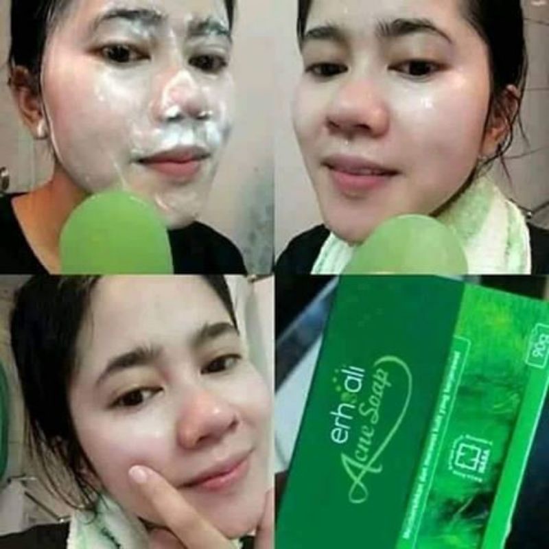 COD FREEONGKIR SABUN ERSHALI ANTI ACNE OBAT SABUN PENGERING DAN MENGATASI JERAWAT