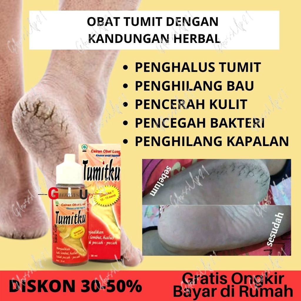 TUMITKU OBAT KAKI PECAH TUMITKU 60ML OBAT HERBAL MENGATASI KAKI PECAH PECAH 60ML ORIGINAL BPOM