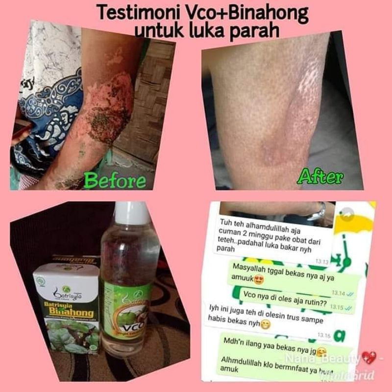 BINAHONG BATRISYIA/ OBAT GATAL EKSIM LUKA BAKAR DIABETES ASAM URAT AMBEIEN MAAGH SAKIT LAMBUNG