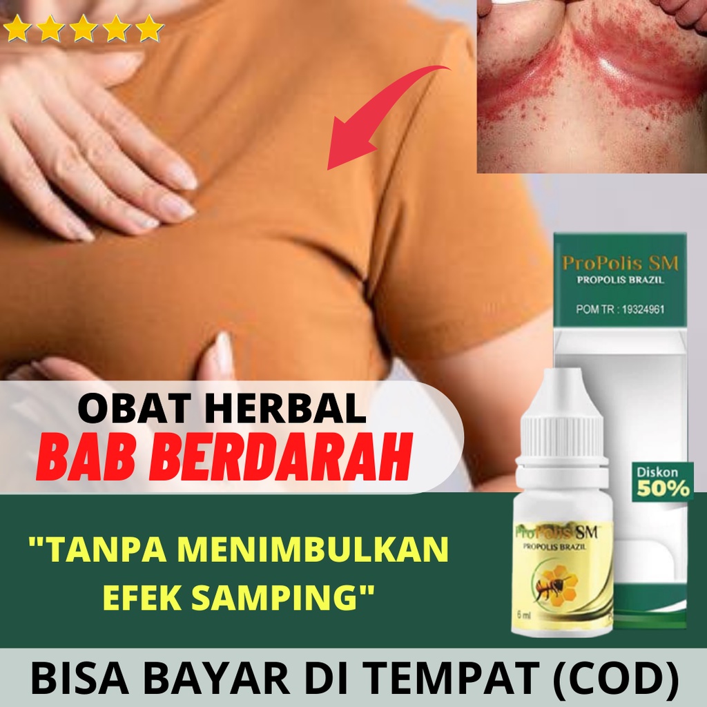 Obat Ruam Di Bawah Payudara Obat Gatal Payudara Ruam Lipatan Payudara Puting Lecet Luka Gatal Berdarah Payudara Bengkak Panas Sering Terasa Sakit Bernanah Iritasi Kulit Benjolan Payudara Kurap Abses Payudara
