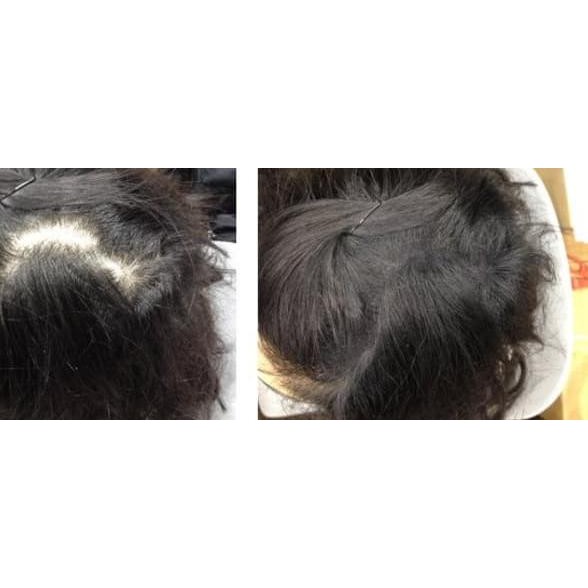 ♗ OCARE HAIR FIBER REFILL 57g HITAM / RAMBUT ANTI BOTAK - Black, 25g ➥