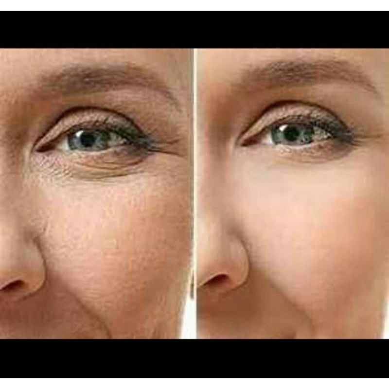 CUKUP 3x DI OLES KANTUNG MATA,KERUTAN,MATA PANDA HILANG PERMANEN SEKETIKA BIG PROMO