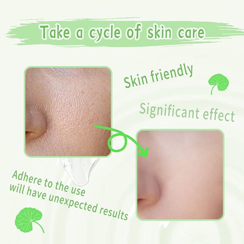 [BPOM] GIRLPAL Centella Asiatica Peeling Gel 100g Facial Glowing Blackhead Cleaner Body Exfoliating Mencerahkan Dan Mengangkat Sel Kulit Mati Girl pal charcoal Girlpal aloevera gel shooting gel