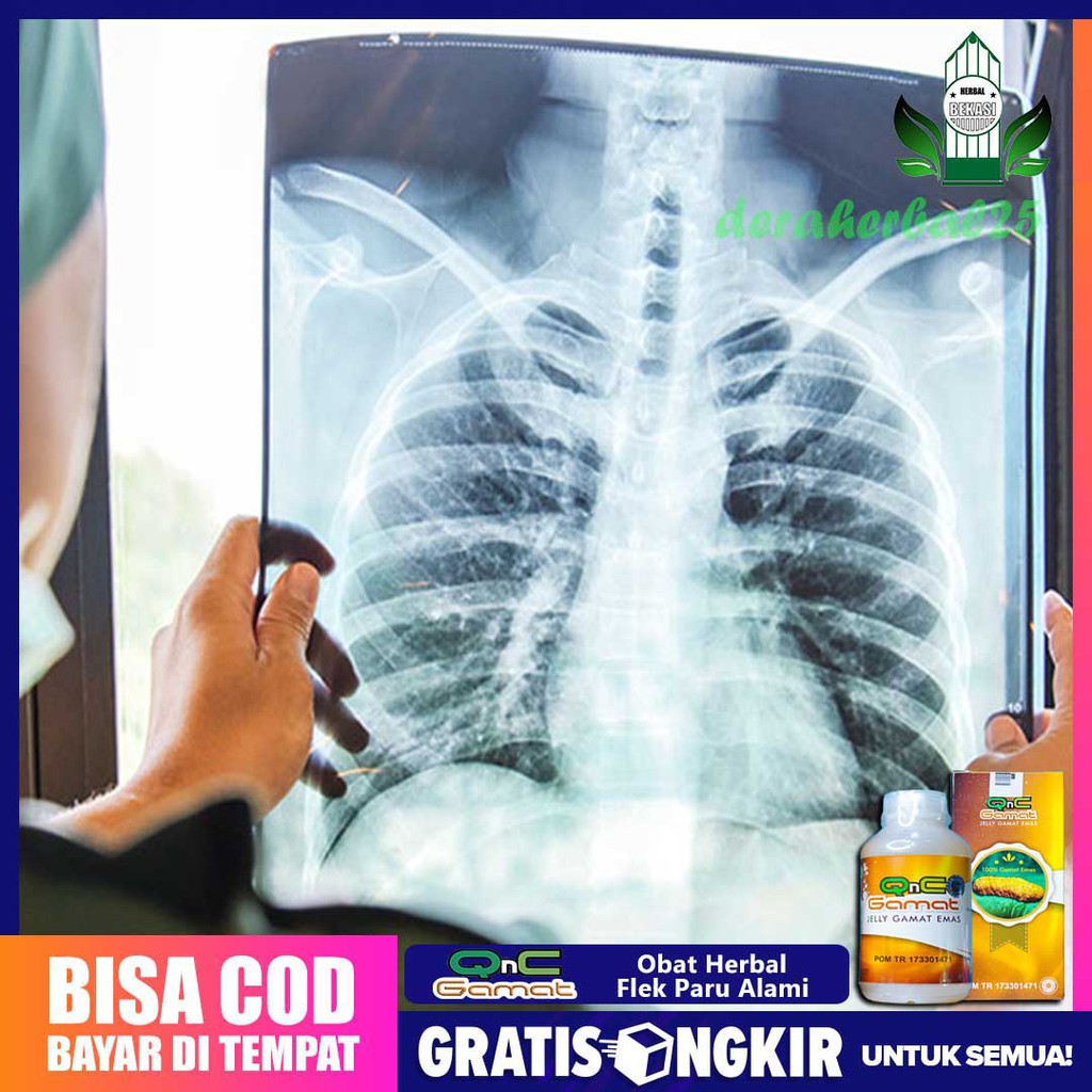 Obat paru paru, nyeri dada, nyeri tulang rusuk, batuk berdahak, nyeri dada, sesak napas Qnc Gamat