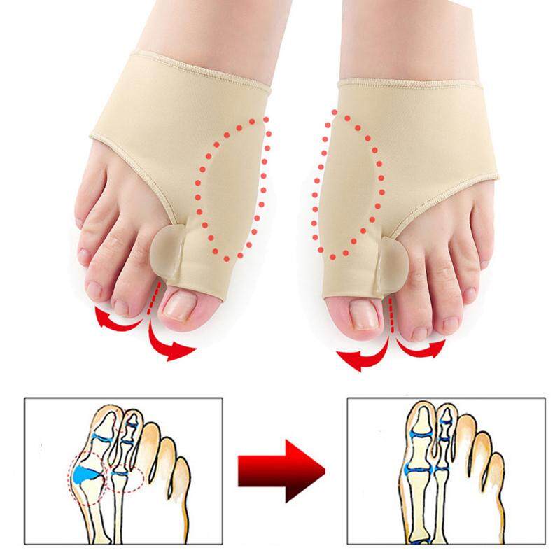 1 Pasang Sleeve Korektor Tulang Jempol Bunion Hallux Orthotics Kaki Corrector Bunion Hallux Orthotic Insole