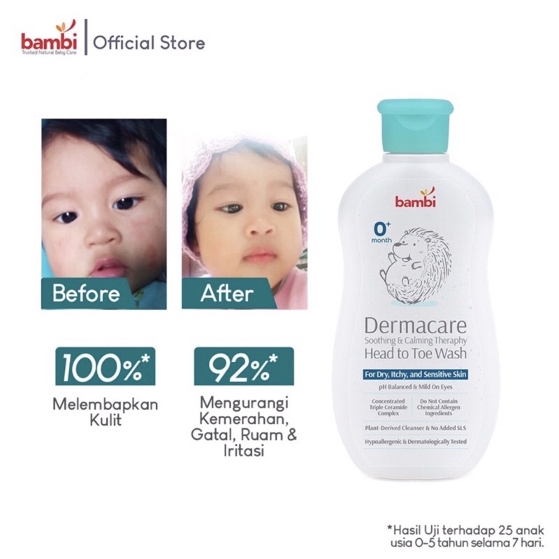 Bambi Sabun Bayi / Head to Toe Wash Sensitif Eksim Ruam Kemerahan Baby Dermacare Daily Soothing &amp; Calming Therapy Head to Toe Wash Bambi Sabun Shampo Bayi Kulit Sensitif