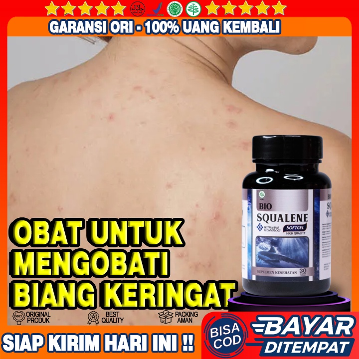 Obat Biang Keringat - Obat Biang Keringat Di Leher - Biang Keringat Gatal Gatal - Gatal Biang Kering