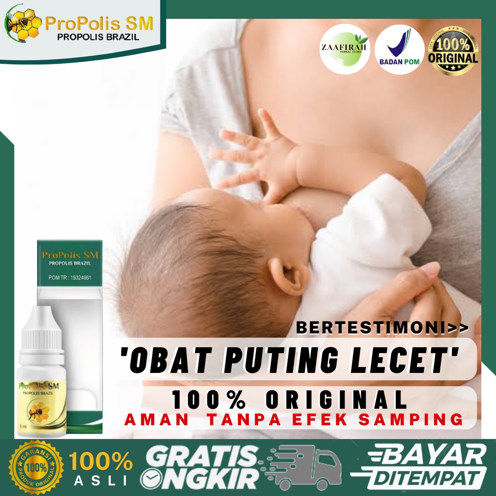 Obat Puting Lecet - Puting Luka - Puting Perih - Obat Puting Sakit Akibat Tergigit Anak - Puting Mem