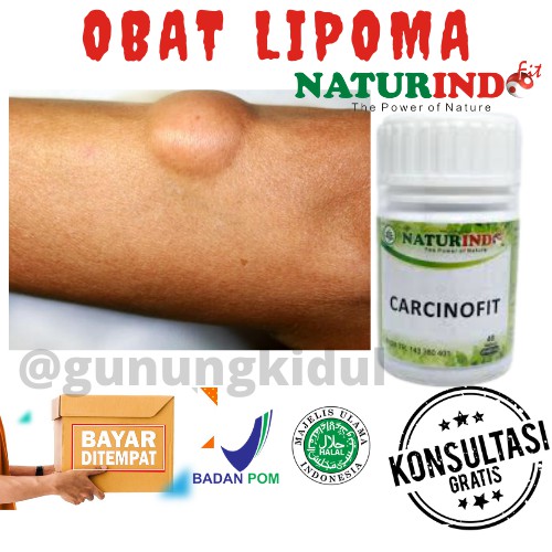 OBAT HERBAL BENJOLAN KANKER TUMOR BISUL JERAWAT BATU LIPOMA UCI UCI HERBAL CARCINOFIT NATURINDO COD-1