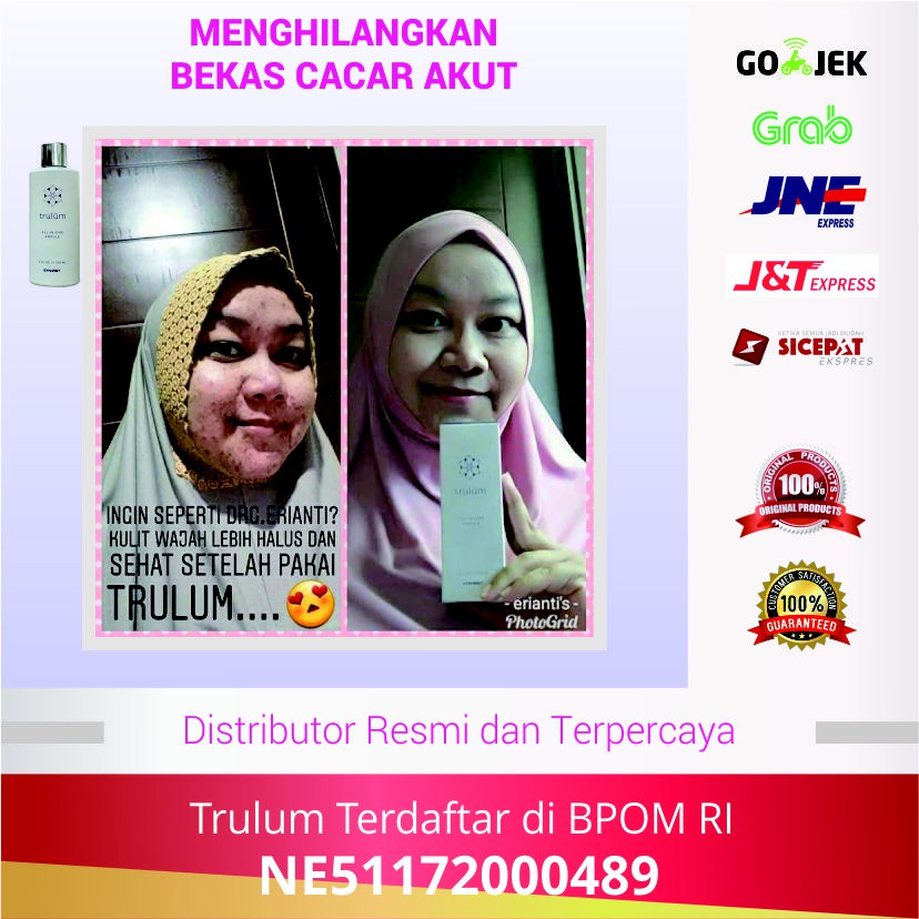 Trulum Menghilangkan Bekas Cacar dan Noda Wajah Lainnya