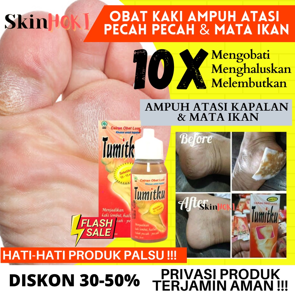 PENGHALUS TUMIT KAKI KASAR DAN PECAH TUMITKU 30ML PENGHILANG KAPALAN ORIGINAL BPOM