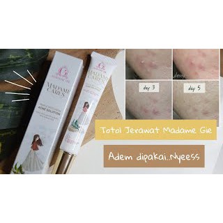 Madame Gie Madame Cares Pimple Spot Cream Acne Solution - Skin Care Acne Spot Gel