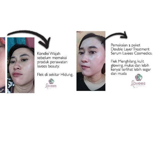 ☼ [SERUM FLEK & MELASMA] Lavees Concentrate Glowhite Serum Essence ❈