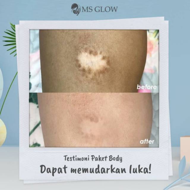 MS Glow Body Lotion - 1 Item - Pemutih Badan