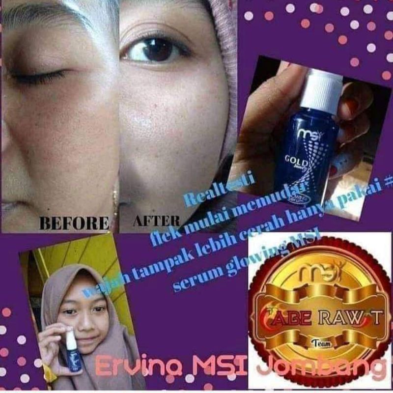 serum glowing MSI
