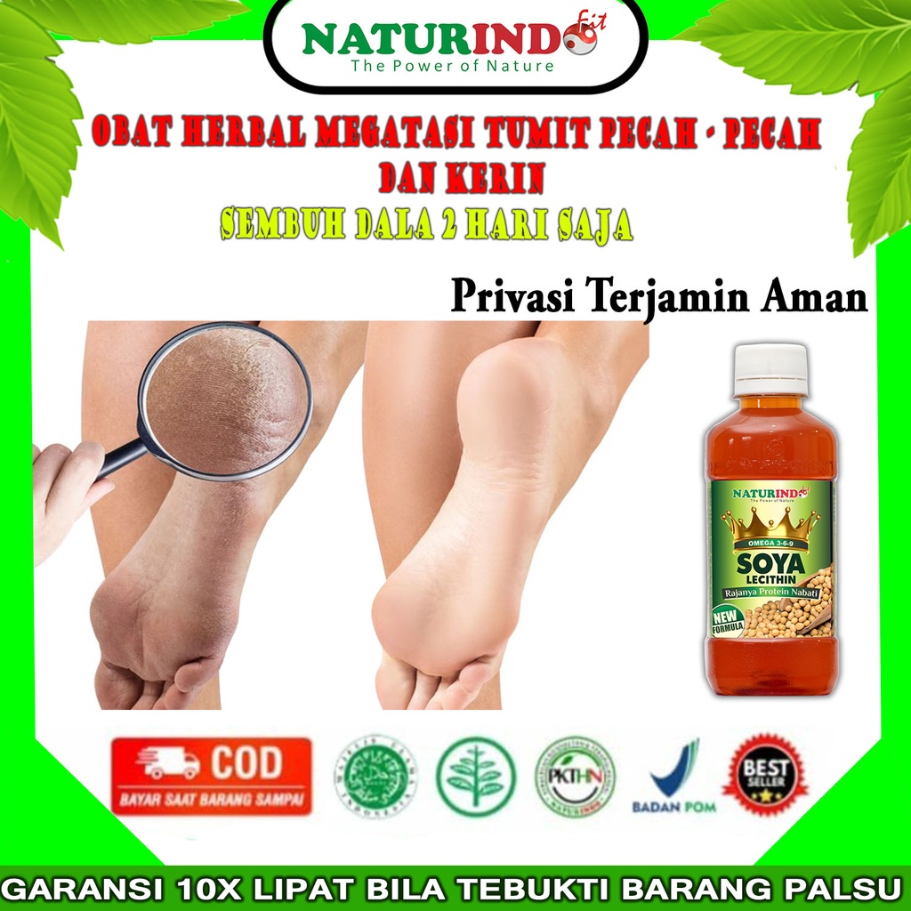 Obat Kaki Pecah-Pecah Kaki Belak Belaken Herbal Paling Ampuh NATURINDO BPOM COD