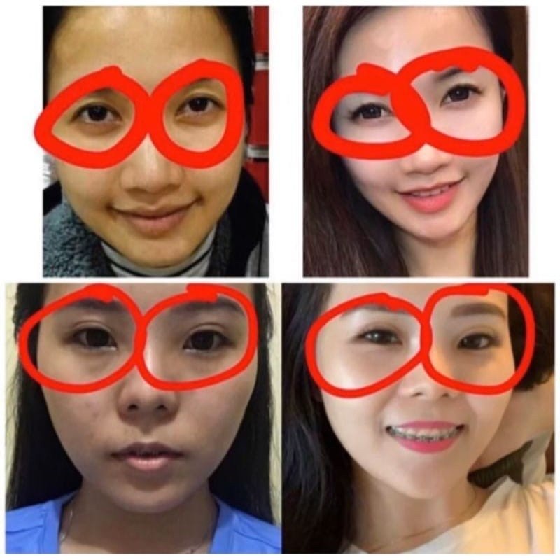 SKIN CARE DR'S SECRET AESTIER EYE CREAM