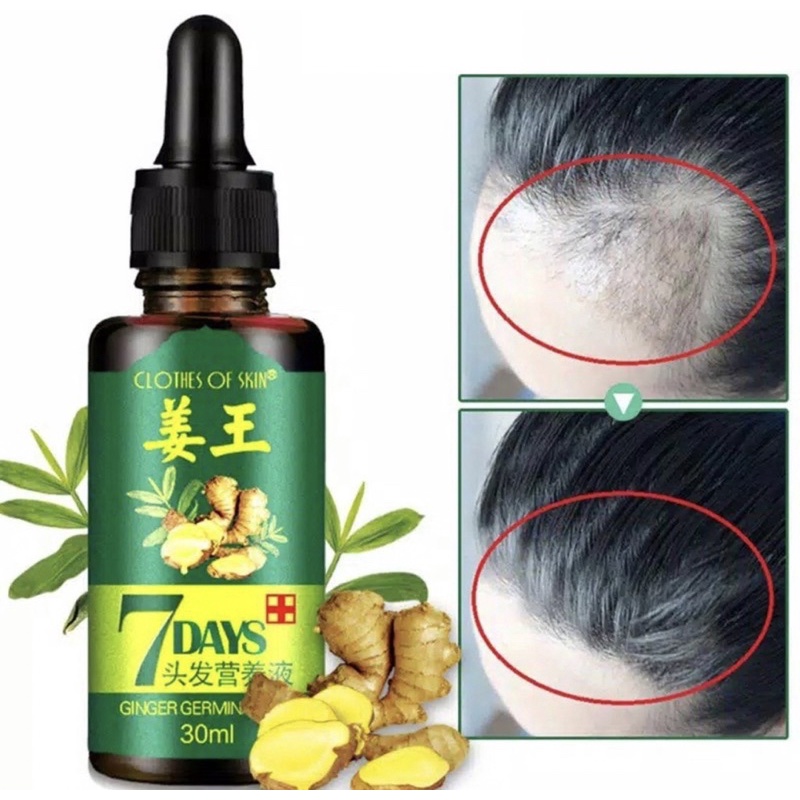 7 Days Clothes Of Skin Ginger Germinal Oil Minyak Penumbuh Rambut