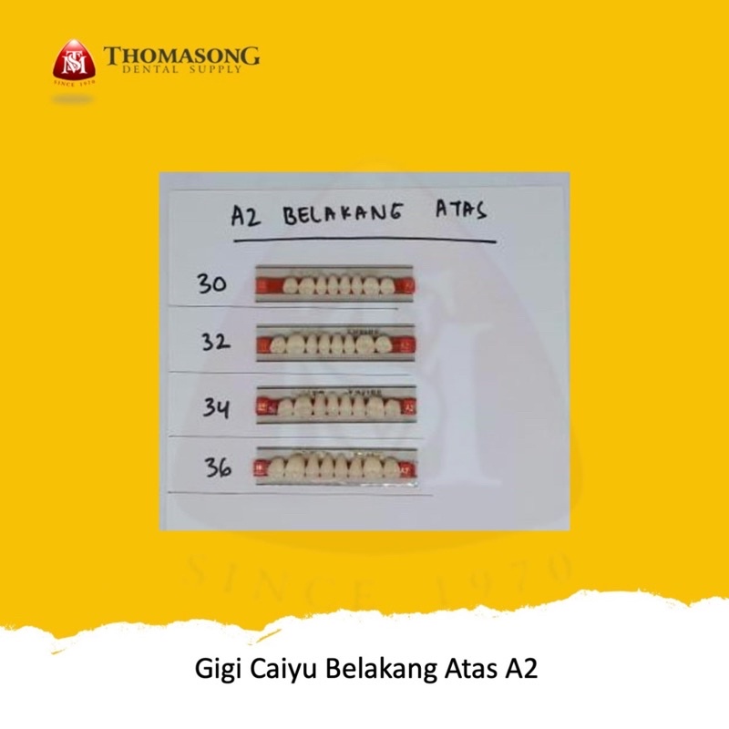 Gigi Palsu Caiyu Belakang Atas A2