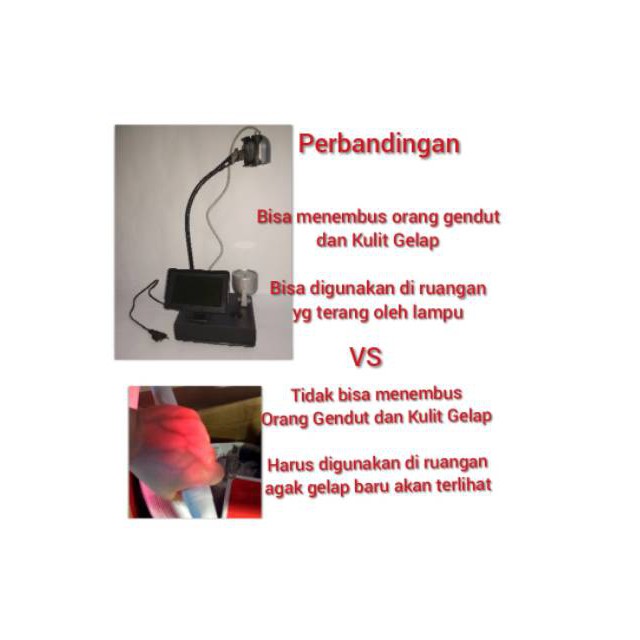 Alat Pencari Vena Saat Pasang Infus Gendut Kulit Gelap ...