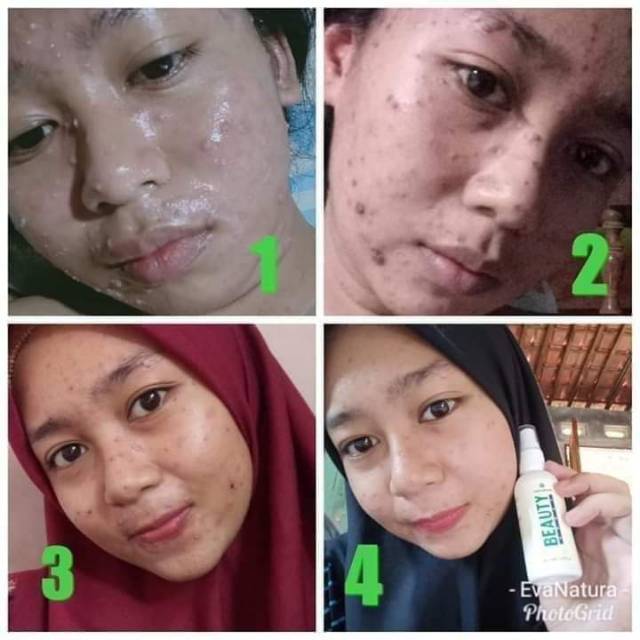Natura beauty spray