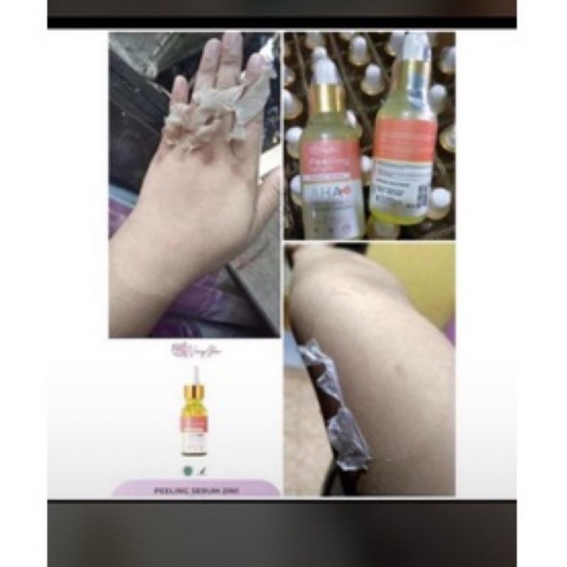 PEELING SERUM AHA ORIGINAL VINCY GLOW PUSAT RESMI