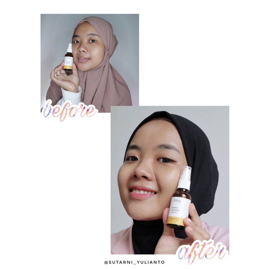 Pratista Retinol Renewal Serum Terbukti Mencerahkan