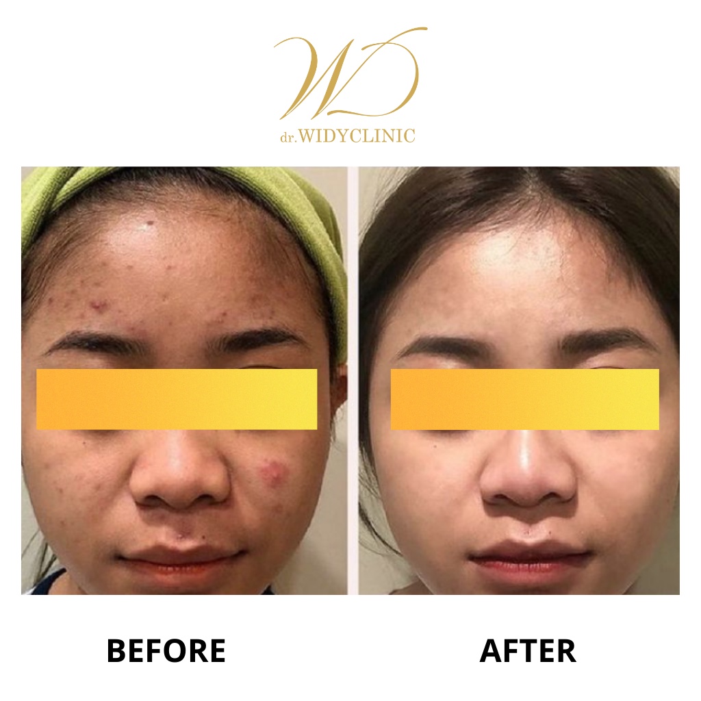 Dr Widy Clinic Whitening Skincare | Paketan Pencerah &amp; Glowing Untuk Semua Jenis Kulit Flek Melasma Bekas Jerawat | BPOM &amp; Halal MUI Formulasi Dokter