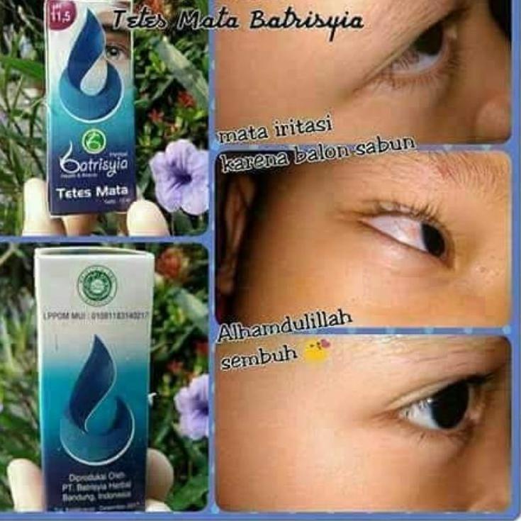 [VnT⭐/obat tetes mata anak herbal/ obat tetes mata bayi/tetes mata bengkak merah belekan aman untuk 