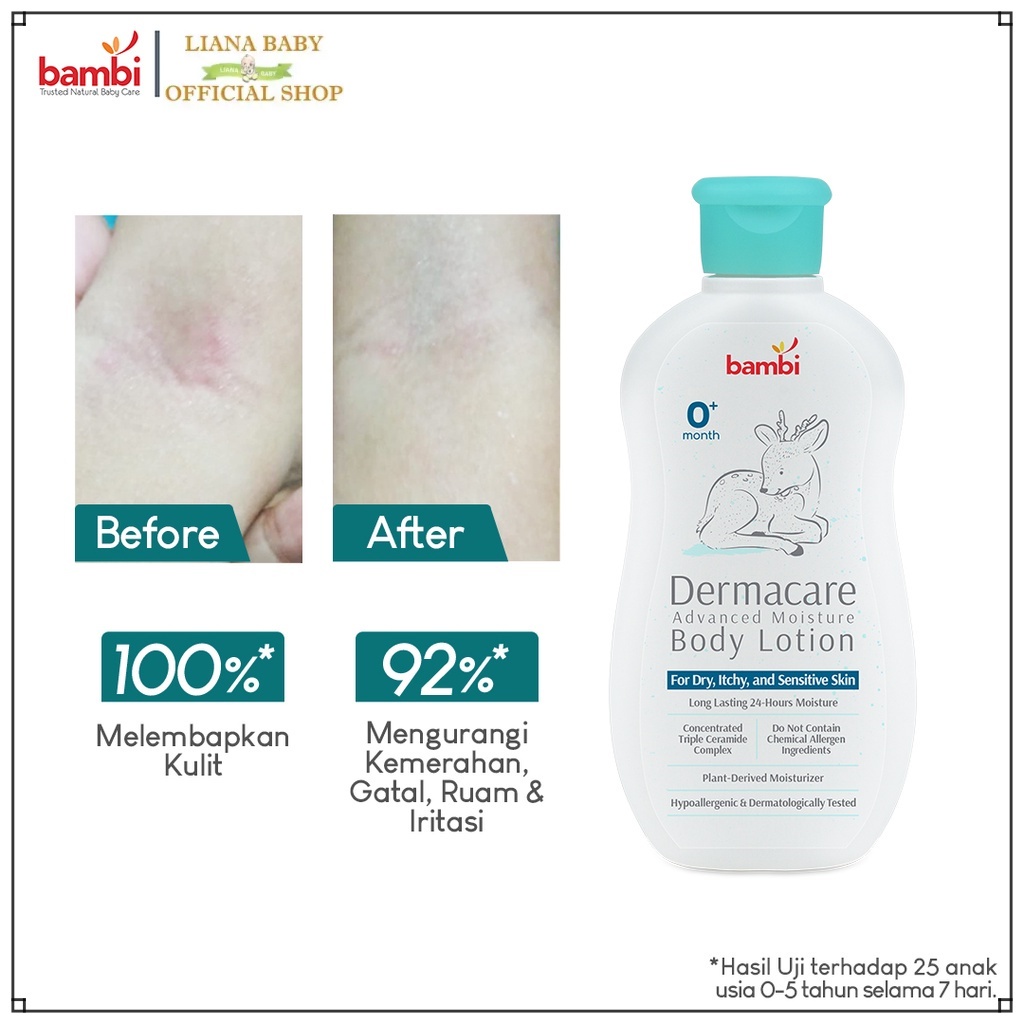 PERA690 BAMBI DERMACARE ADVANCED MOISTURE BODY LOTION BAYI KULIT KERING&amp;SENSITIF