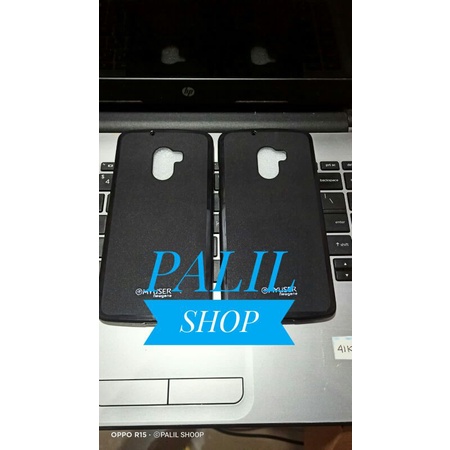 Soft Case Lenovo Vibe k4 NOTE A7010 Vibe shot hitam
