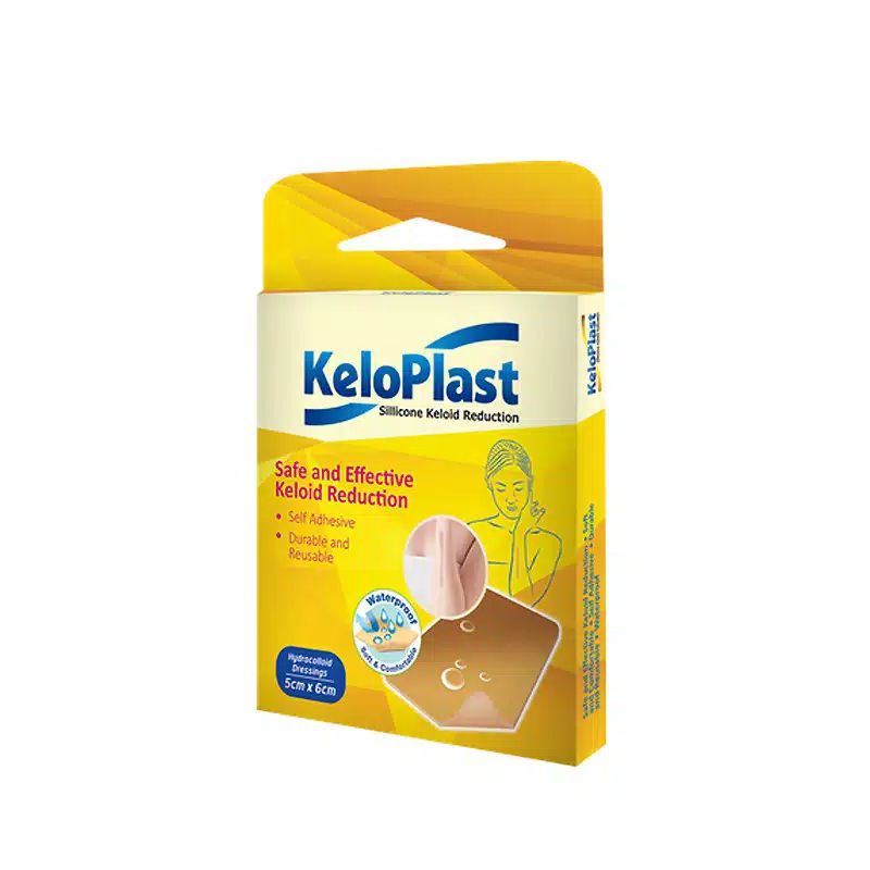 Keloplast Silicon Keloid / Scar / bekas luka