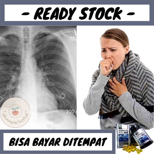 Obat Paru Paru Basah, Obat Pneumonia, Obat Penyakit Paru Paru, Suplemen Kesehatan Paru Paru - Obat H