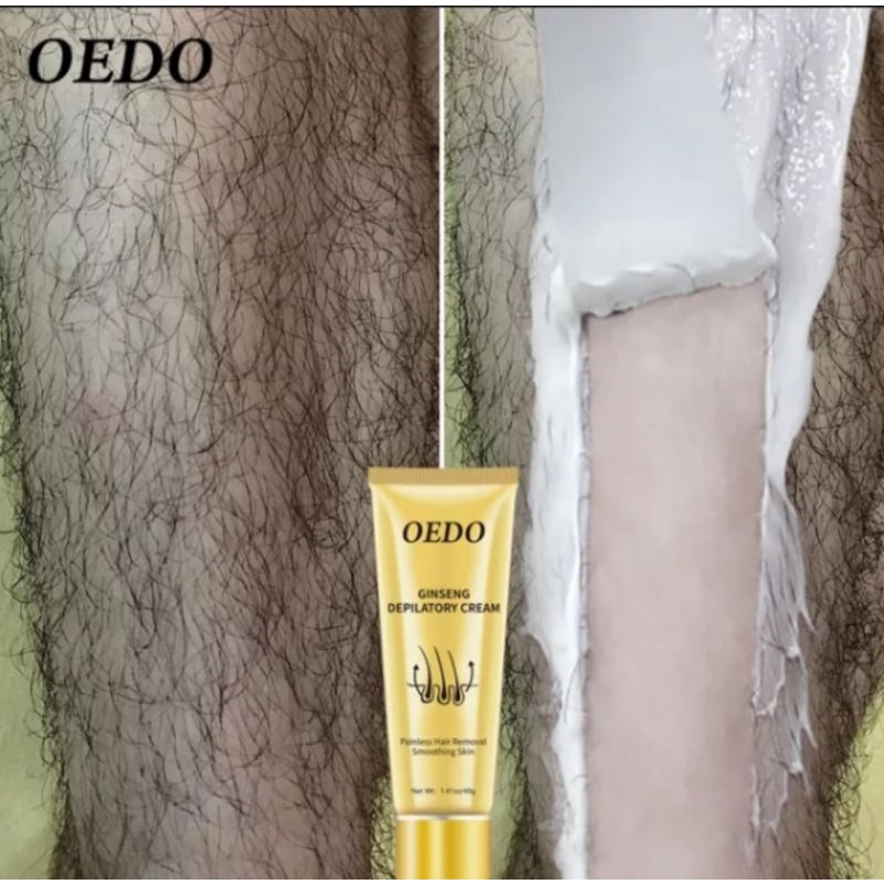 [Ready] OEDO Gingseng body hair removal/perontok bulu/penghilang bulu ketiak/penghilang bulu kaki/pe