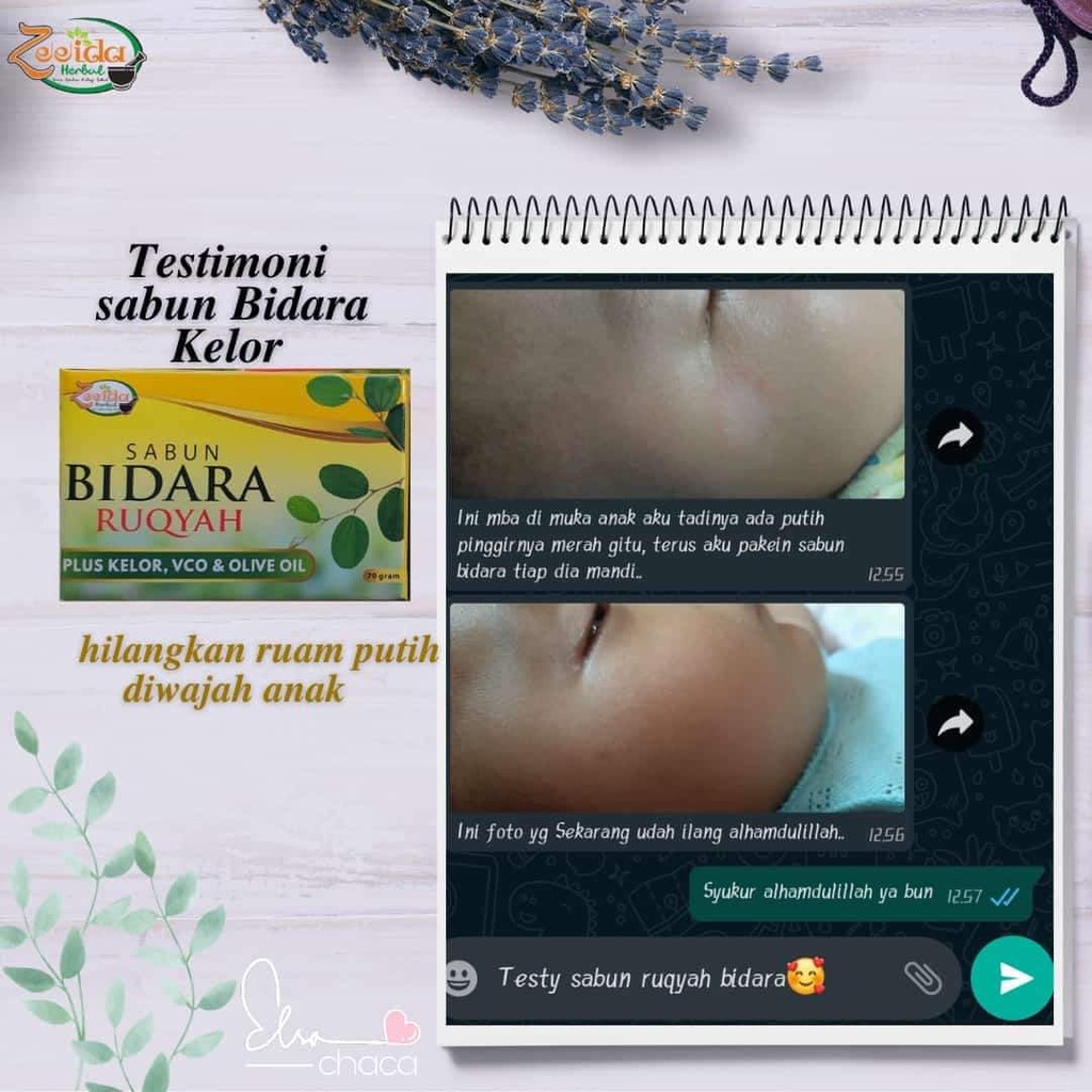 SABUN BIDARA ZEEIDA ANTI AGING , OBAT JERAWAT