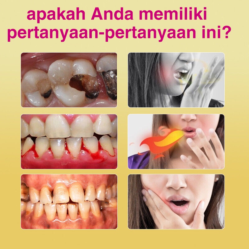 Pasta gigi pemutih probiotik Mencegah kerusakan gigi Melindungi gusi Ubat gigi probiotik Pemutih gigi Nafas segar Menghilangkan kalkulus gigi rasa permen karet