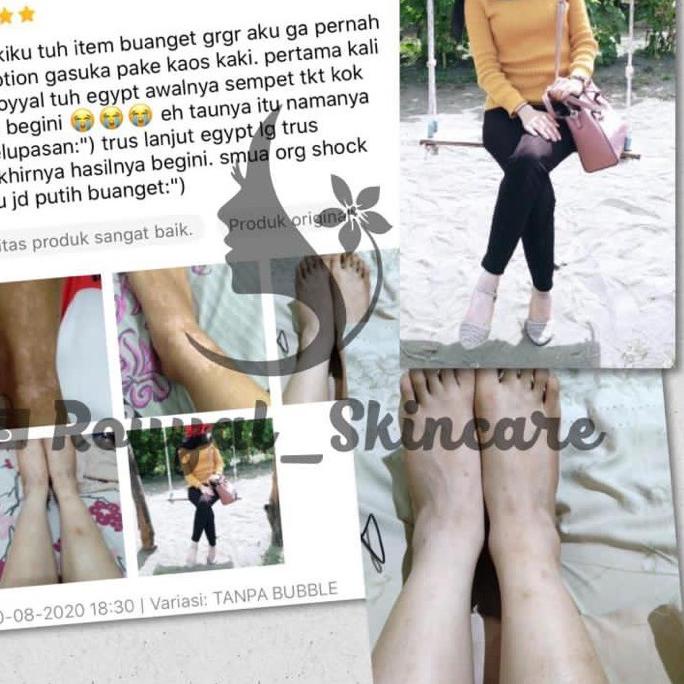 ▼ TONER PENGELUPASAN [ EXFOLIATING TONER { ℮