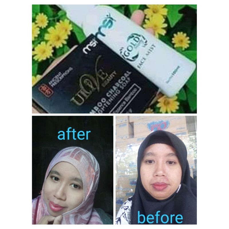 paket jerawat msi mencerahkan wajah menghilangkan flek hitam menghaluskan wajahmengecilkanporipori