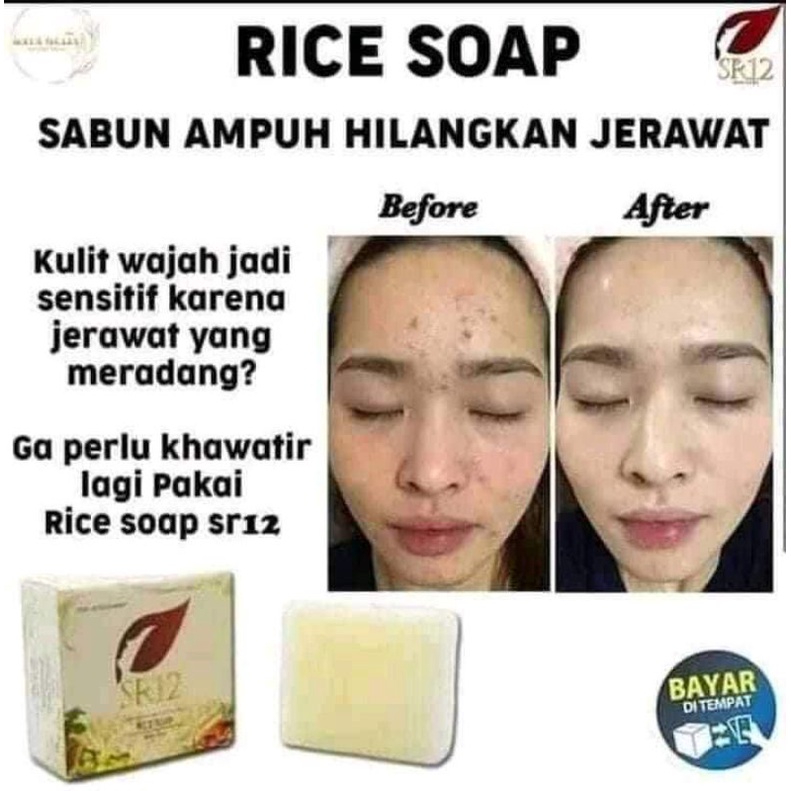 

SABUN BERAS HERBAL SR12 TERLARIS..!! RICE SOAP / SABUN JERAWAT BPOM / KULIT BERMINYAK & SENSITIF