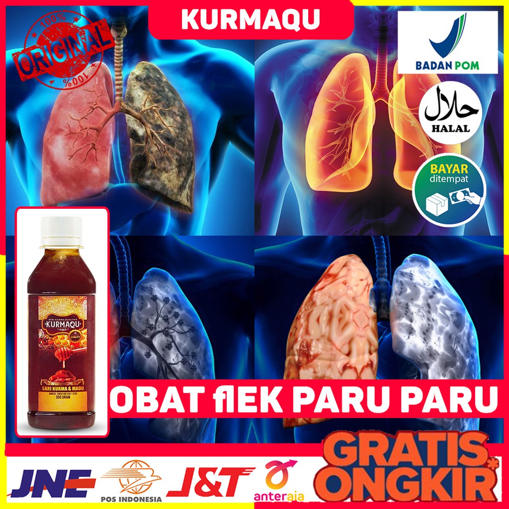 Obat Flek Paru - Paru, Pneumonia, Paru - Paru Kering & Basah, TBC, Kanker Paru - Paru, Kurmaqu Solo