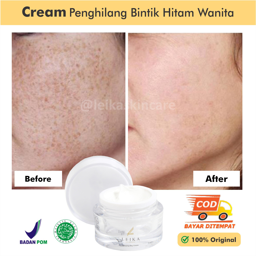 Penghilang Bintik Hitam Di Wajah Ampuh Bpom Penghilang Noda Hitam Di Wajah Cream Penghilang Bintik H