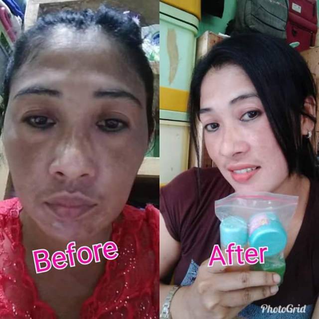 Harga Spesial - . CREAM CM CUCOK MEONG KOSMETIK BUMIL BUSUI CREAM CM CUCO MEONG CM IMELDA YUNUS sk