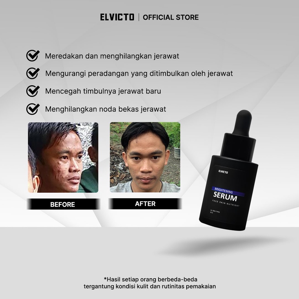 ELVICTO BRIGHTENING SERUM