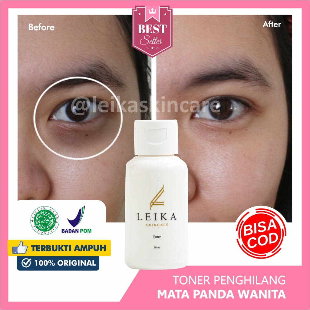 Toner Penghilang Mata Panda Wanita Halal Penghilang Kantung Mata Bpom Cream Mata Panda Ampuh penghil