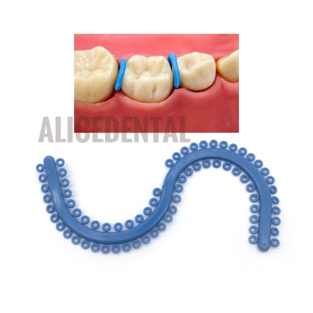 Dental elastic separator molar band ring ortho orthodontic type S karet elastik gigi behel molarband