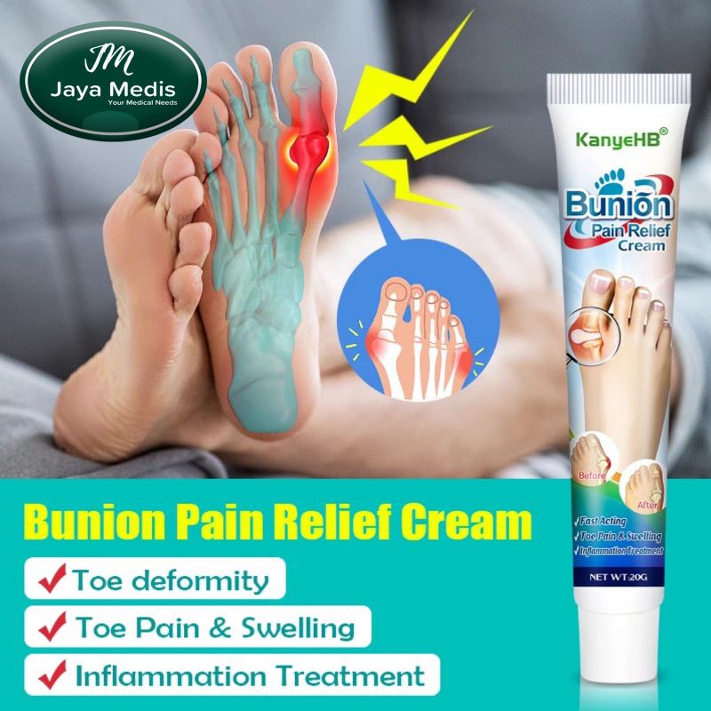 Cream Nyeri Sendi Valgus Arthritis - Bunion Pain Relief Cream 20g