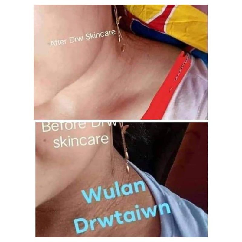 DRW Skincare Brightening Neck Cream Pencerah leher By dr. Wahyu Triasmara